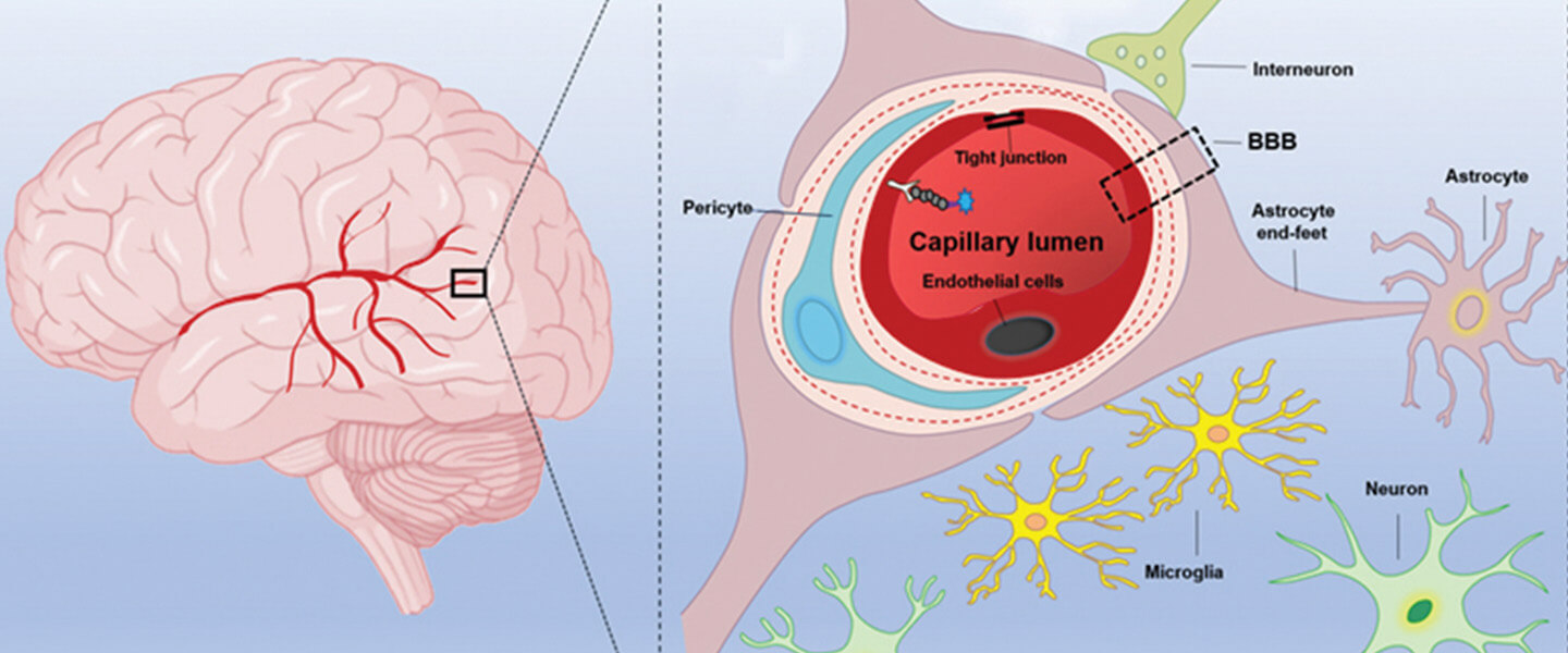 How COVID Infection May Damage the Brain and Affect Mental Illness Symptoms & Mortality