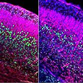 Photo credit: Case Western Reserve University School of Medicine Photo credit: Case Western Reserve University School of Medicine