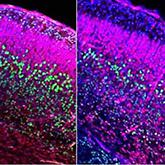 Mouse Study Links Abnormal Social Behavior to Critical Prenatal Period of Brain Development
