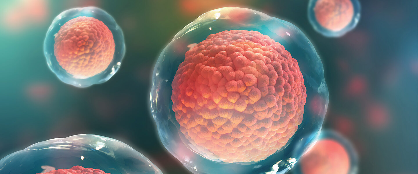 Stem Cell Technology Helps Identify a Potential Causal Mechanism in Schizophrenia That Could Be Targeted
Stem Cell Technology Helps Identify a Potential Causal Mechanism in Schizophrenia That Could Be Targeted