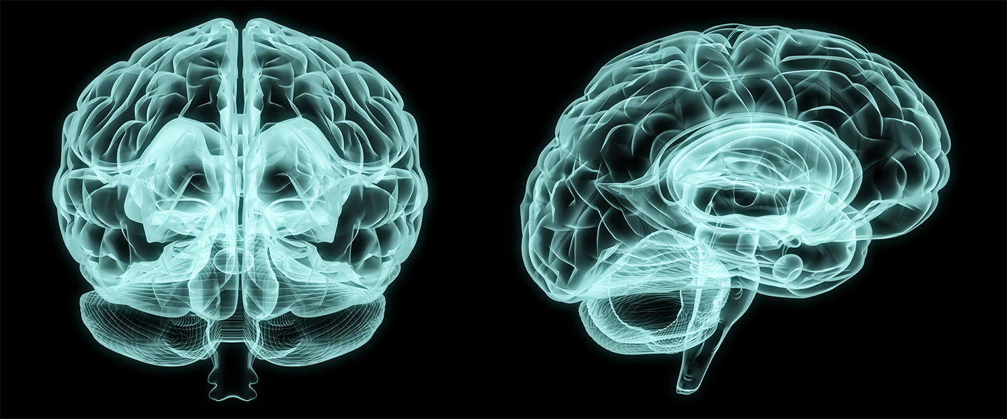 Analysis of Brain Scans Reveals Differences in Brains of Boys and Girls with Autism Spectrum Disorder
