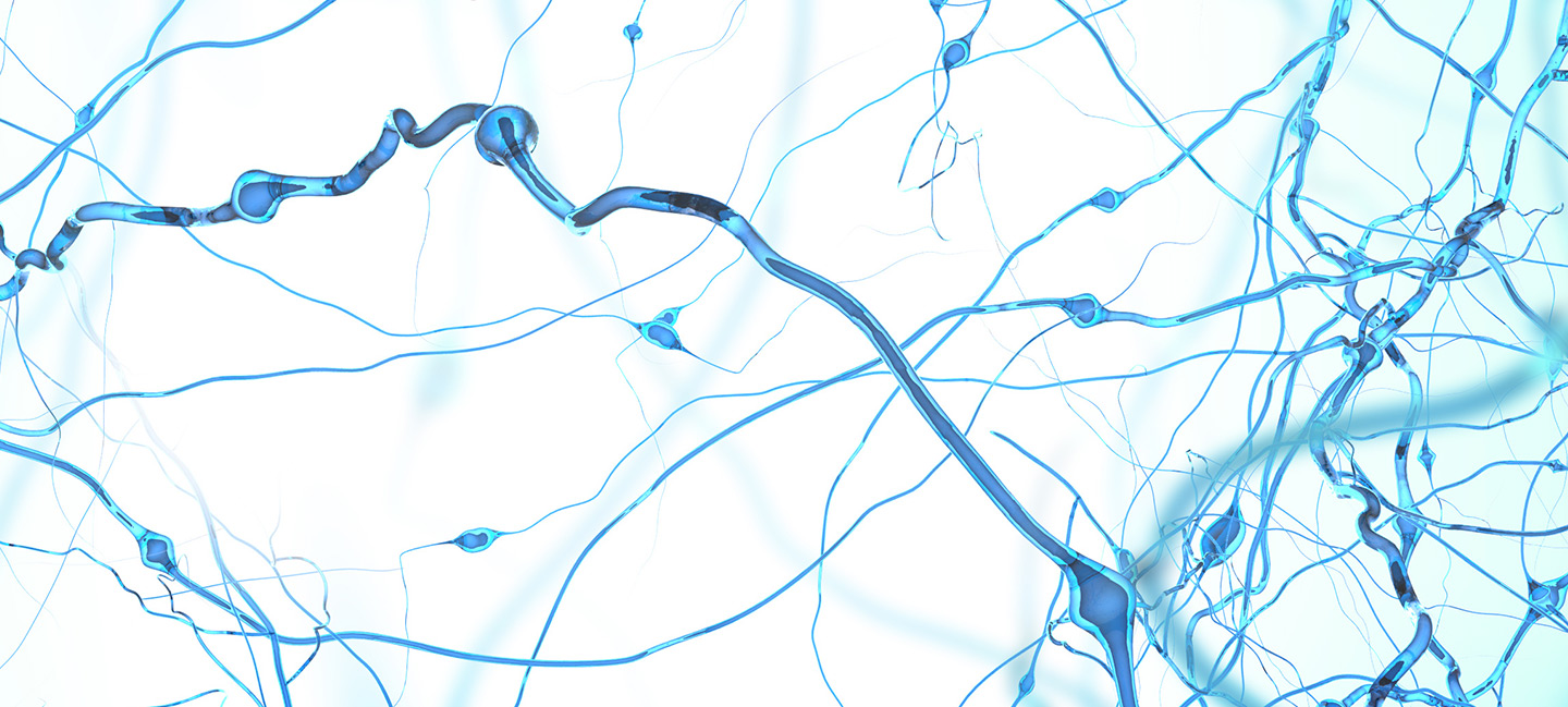 Diabetes Risk is Increased Even at the Start of Schizophrenia