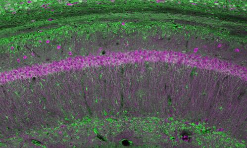 Variations in Schizophrenia-Linked Gene Are Linked With Pathology in Prefrontal Cortex, Impairing Cognition Variations in Schizophrenia-Linked Gene Are Linked With Pathology in Prefrontal Cortex, Impairing Cognition