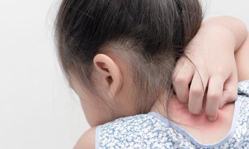 Insights Into Sensory Symptoms in Autism and Other Disorders from Stem Cell-Based Model of Key Human Sensory Pathway Insights Into Sensory Symptoms in Autism and Other Disorders from Stem Cell-Based Model of Key Human Sensory Pathway