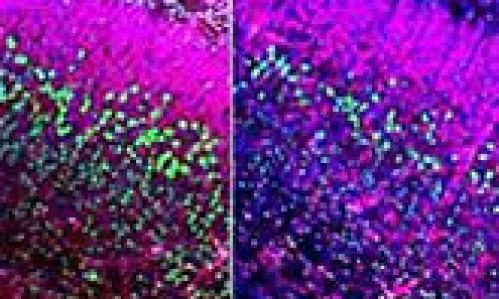 Photo credit: Case Western Reserve University School of Medicine Photo credit: Case Western Reserve University School of Medicine