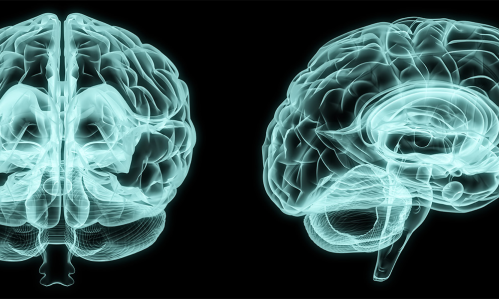 Analysis of Brain Scans Reveals Differences in Brains of Boys and Girls with Autism Spectrum Disorder Analysis of Brain Scans Reveals Differences in Brains of Boys and Girls with Autism Spectrum Disorder