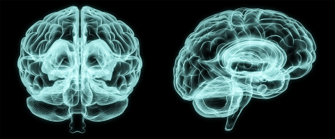 Analysis of Brain Scans Reveals Differences in Brains of Boys and Girls with Autism Spectrum Disorder