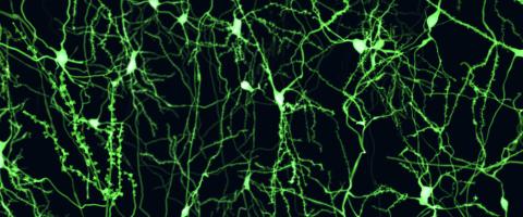 Functional Connectivity Brain Changes Involving Linkages Between Cognition and Motor Function Are Discerned in OCD Patients