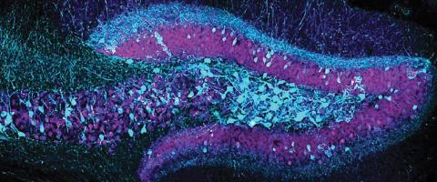 Harnessing Memory’s Malleability to ‘Rewrite’ Fear and Other Negative Memories Harnessing Memory’s Malleability to ‘Rewrite’ Fear and Other Negative Memories